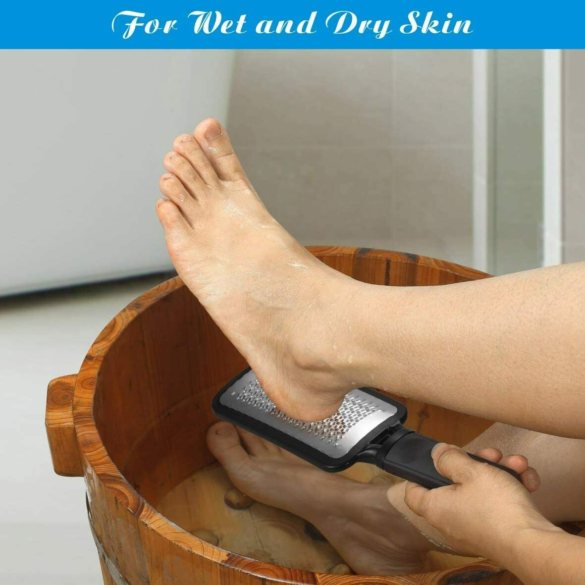 Foot File Callus Remover Pedicure Tool