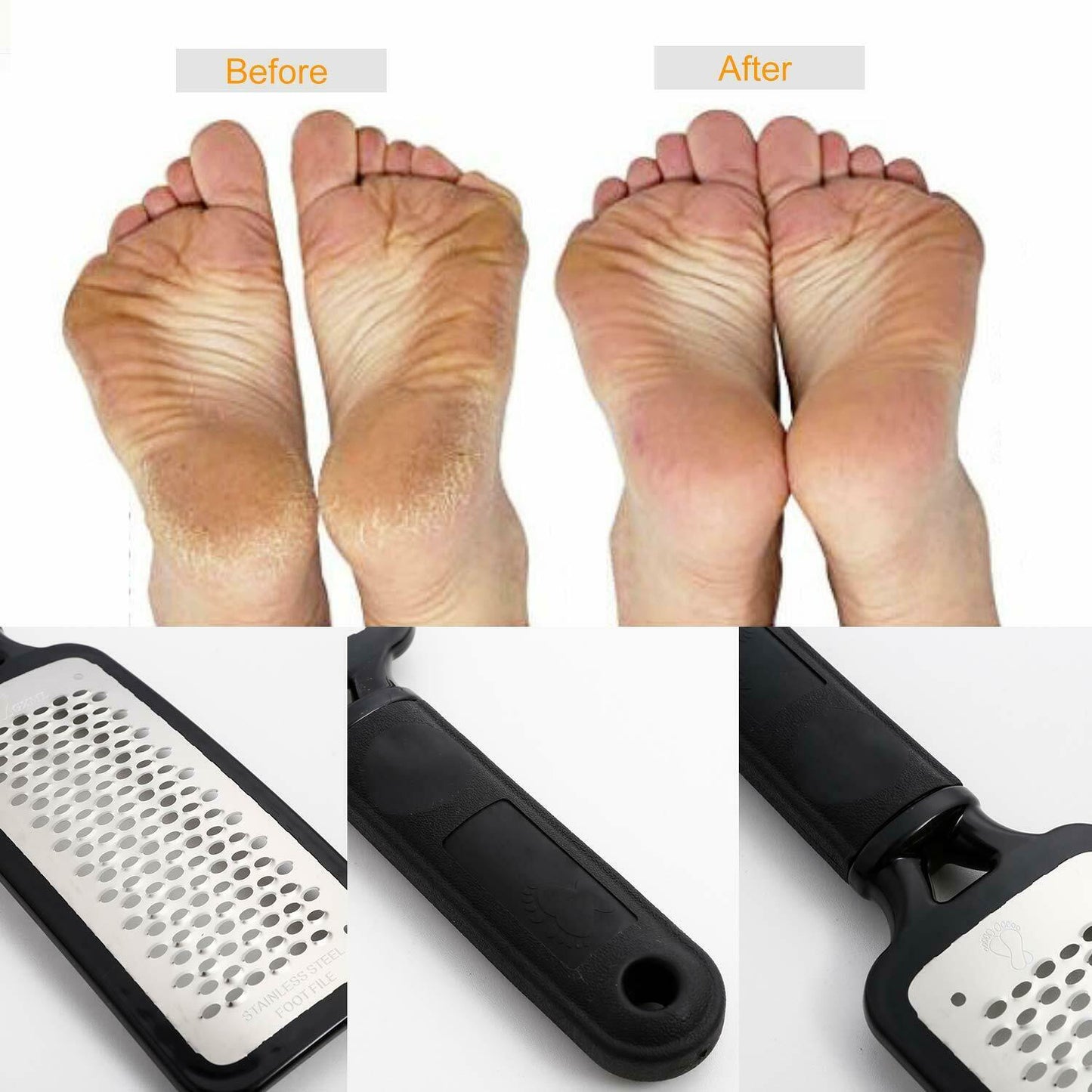 Foot File Callus Remover Pedicure Tool