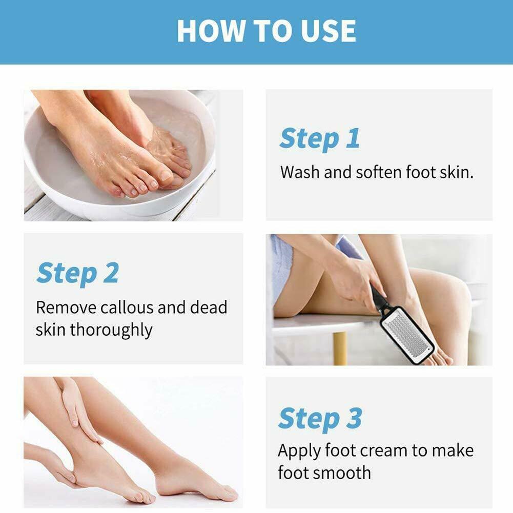 Foot File Callus Remover Pedicure Tool